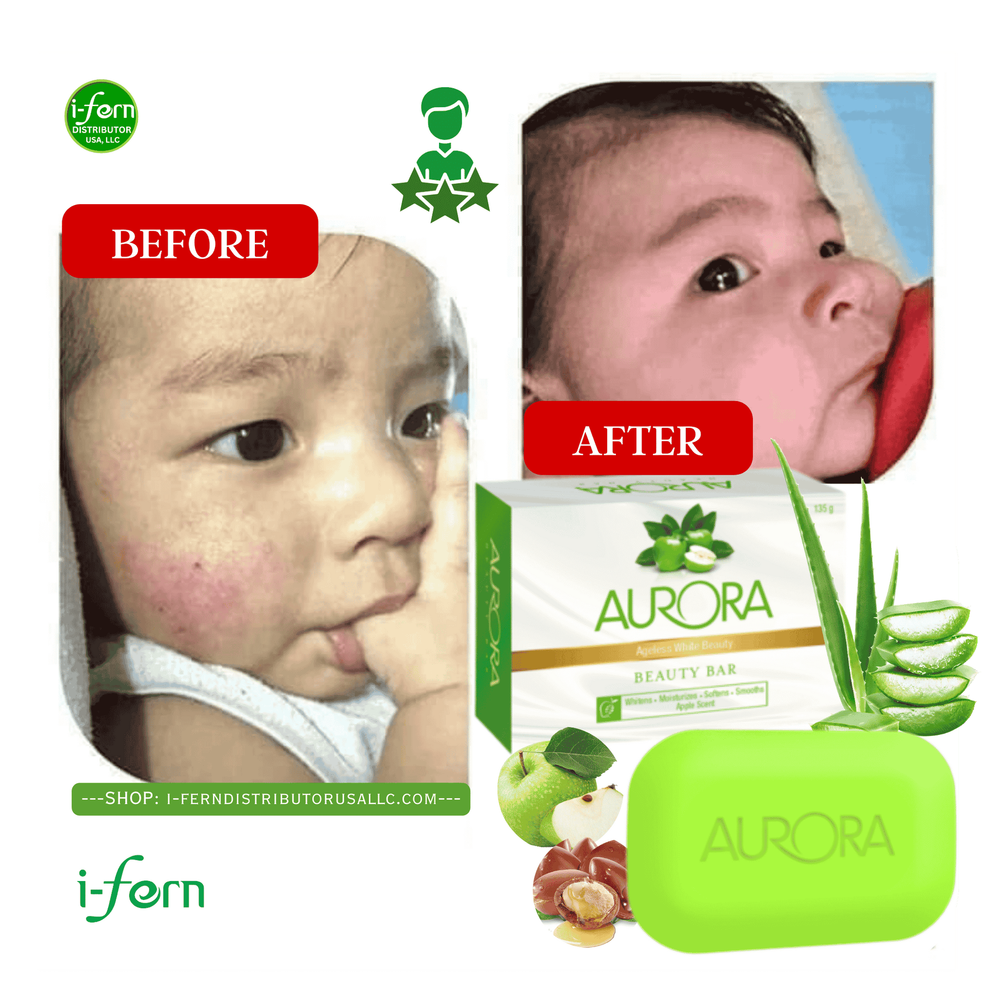 Before and after comparison of a child's skin with Aurora soap sold online on i-ferndistiributorusallc.com displayed.
