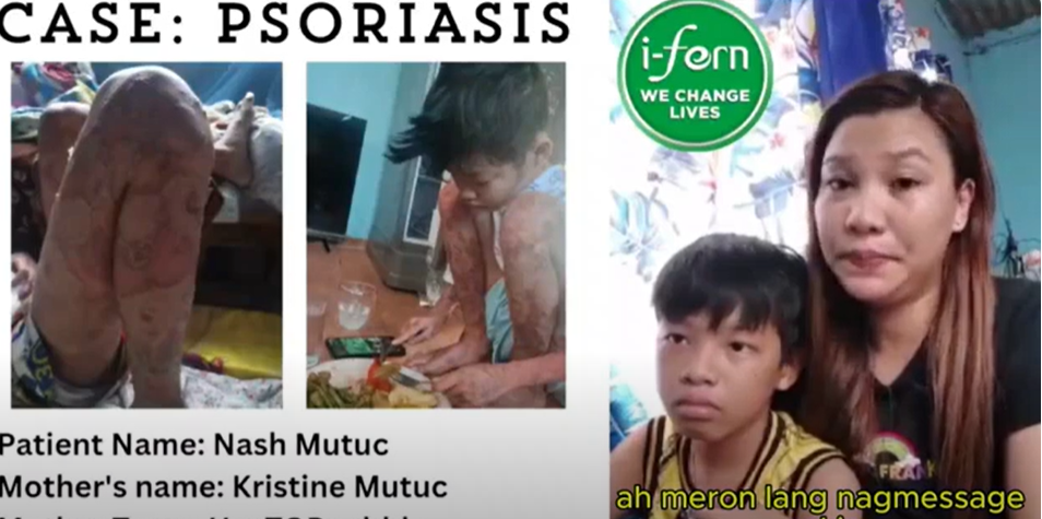 Load video: Christine Mutuc shares her family&#39;s experience with I-Fern products.  She discusses how I-Fern products have supported her son Nash&#39;s skin health and overall well-being.